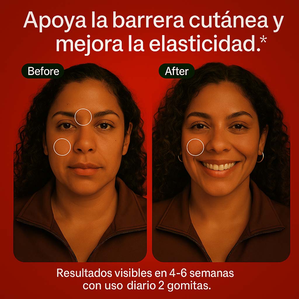 Después